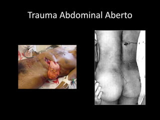 Trauma Abdominal Aberto 
 