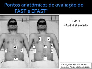 EFAST:
FAST-Estendido
1. Flato, UAP. Rev. bras. terapia
intensiva. Vol.22. São Paulo, 2010.
 