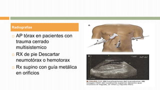  AP tórax en pacientes con
trauma cerrado
multisistemico
 RX de pie Descartar
neumotórax o hemotorax
 Rx supino con guía metálica
en orificios
 Rápido para identificación
de hemorragia.
 Causas de hipotensión no
hipovolemica
Radiografías
Evaluación con ultrasonido focalizado en
trauma (FAST)
 