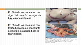  En 30% de los pacientes con
signo del cinturón de seguridad
hay lesiones internas
 En 85% de los pacientes con
lesión hepática no penetrante
se logra la estabilidad con la
reanimación
 