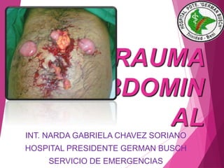 TRAUMA
ABDOMIN
AL
INT. NARDA GABRIELA CHAVEZ SORIANO
HOSPITAL PRESIDENTE GERMAN BUSCH
SERVICIO DE EMERGENCIAS
 