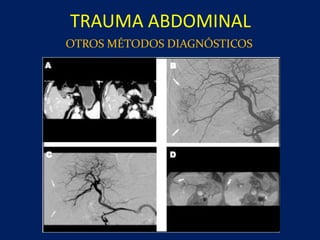 TRAUMA ABDOMINAL
OTROS MÉTODOS DIAGNÓSTICOS
 