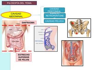 ESTRECHO
SUPERIOR
DE PELVIS
DIAFRAGMA
FILOSOFÍA DEL TEMA
CAVIDAD
ABDOMINAL
CAVIDAD
PERITONEAL
ESPACIO
RETROPERITONE
AL
CAVIDAD PÉLVICA
 