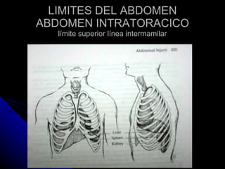 Trauma Abdominal Cerrado | PPT