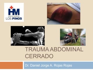 TRAUMA ABDOMINAL
CERRADO
Dr. Daniel Jorge A. Rojas Rojas
 