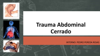 Trauma Abdominal
Cerrado
INTERNO: PEDRO PEREDA ROJAS
 