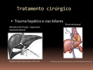 Tratamento cirúrgico

   Trauma hepático e vias biliares
                                                                        Shunt atriocaval
Manobra de Pringle – ligamento
hepatoduodenal




http://www.hepato-biliarysurgery.com/tve.html   http://129.49.170.167/Volumes/ACS+Oct+2010/ACSCD/figures/ch0707-f9.htm
 