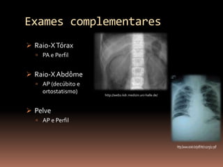 Exames complementares
 Raio-X Tórax
   PA e Perfil


 Raio-X Abdôme
   AP (decúbito e
    ortostatismo)    http://web1-kdr.medizin.uni-halle.de/



 Pelve
   AP e Perfil
 
