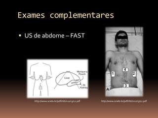 Exames complementares

 US de abdome – FAST




     http://www.scielo.br/pdf/rbti/v22n3/12.pdf   http://www.scielo.br/pdf/rbti/v22n3/12.pdf
 
