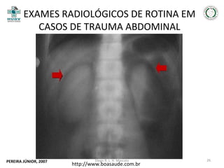 EXAMES RADIOLÓGICOS DE ROTINA EM
CASOS DE TRAUMA ABDOMINAL

PEREIRA JÚNIOR, 2007

Diego R. L. H. Mascato

http://www.boasaude.com.br

26

 