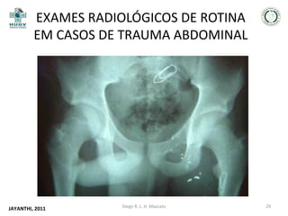 EXAMES RADIOLÓGICOS DE ROTINA
EM CASOS DE TRAUMA ABDOMINAL

JAYANTHI, 2011

Diego R. L. H. Mascato

29

 