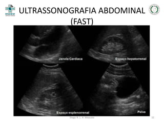 ULTRASSONOGRAFIA ABDOMINAL
(FAST)

JAYANTHI, 2011

Diego R. L. H. Mascato

32

 