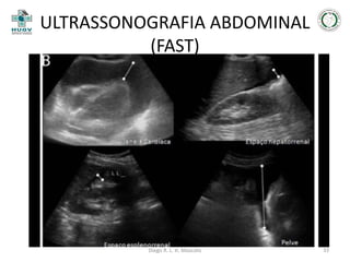 ULTRASSONOGRAFIA ABDOMINAL
(FAST)

JAYANTHI, 2011

Diego R. L. H. Mascato

33

 