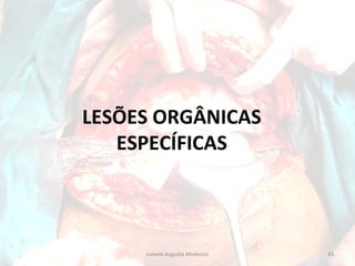 LESÕES ORGÂNICAS
ESPECÍFICAS

Izabela Augusta Medeiros

43

 