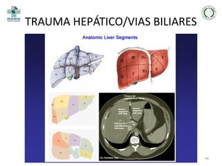 TRAUMA HEPÁTICO/VIAS BILIARES

48

 