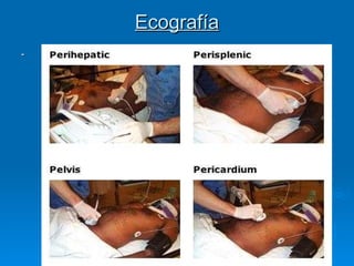 Ecografía - 