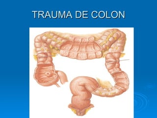 TRAUMA DE COLON 