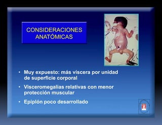 CONSIDERACIONES
ANATÓMICAS
• Muy expuesto: más víscera por unidad
de superficie corporal
• Visceromegalias relativas con menor
protección muscular
• Epiplón poco desarrollado
 