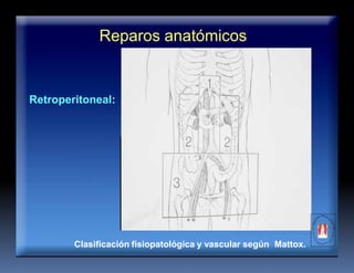 Reparos anatómicos
Retroperitoneal:
Clasificación fisiopatológica y vascular según Mattox.
 