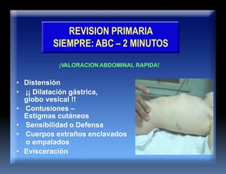 REVISION PRIMARIA
SIEMPRE: ABC – 2 MINUTOS
¡VALORACION ABDOMINAL RAPIDA!
• Distensión
• ¡¡ Dilatación gástrica,
globo vesical !!
• Contusiones –
Estigmas cutáneos
• Sensibilidad o Defensa
• Cuerpos extraños enclavados
o empalados
• Evisceración
 