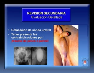 REVISION SECUNDARIA
Evaluación Detallada
• Colocación de sonda uretral
• Tener presente las
contraindicaciones por
¡trauma de pelvis o periné!
 