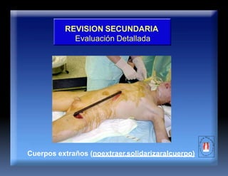 REVISION SECUNDARIA
Evaluación Detallada
Cuerpos extraños (noextraer,solidarizaralcuerpo)
 