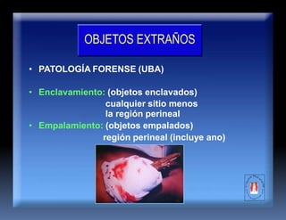 OBJETOS EXTRAÑOS
• PATOLOGÍA FORENSE (UBA)
• Enclavamiento: (objetos enclavados)
cualquier sitio menos
la región perineal
• Empalamiento: (objetos empalados)
región perineal (incluye ano)
 