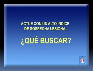 ACTUE CON UNALTO INDICE
DE SOSPECHALESIONAL
¿QUÉ BUSCAR?
 