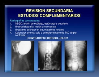 contraste)
REVISION SECUNDARIA
ESTUDIOS COMPLEMENTARIOS
Radiografías contrastadas:
1. SEGD: lesión de esófago, estómago y duodeno
2. Uretrocistografía: lesión uretrovesical
3. Urograma excretor en traumatismos renales
4. Colon por enema: solo o complementario de TAC (triple
¡CONTRASTES HIDROSOLUBLES!
 