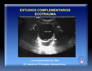ESTUDIOS COMPLEMENTARIOS
ECOTRAUMA
y una especificidad del 100%
Ej: Líquido en FS Douglas- Hemoperitoneo
 