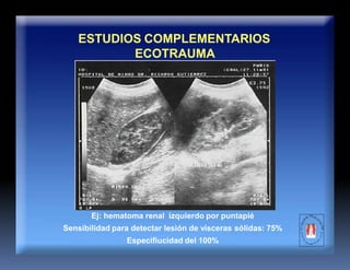 ESTUDIOS COMPLEMENTARIOS
ECOTRAUMA
Ej: hematoma renal izquierdo por puntapié
Sensibilidad para detectar lesión de visceras sólidas: 75%
Especifiucidad del 100%
 