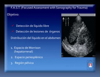 F.A.S.T. (Focused Assessment with Sonography forTrauma)
Objetivo:
 Detección de líquido libre
 Detección de lesiones de órganos
Distribución del líquido en el abdomen
1. Espacio de Morrison
(hepatorrenal)
2. Espacio periesplénico
3. Región pélvica
 