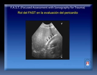 F.A.S.T. (Focused Assessment with Sonography forTrauma)
Rol del FAST en la evaluación del pericardio
 