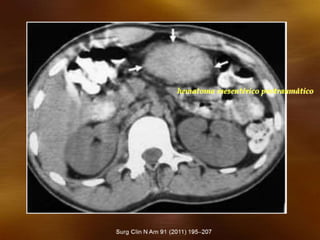 hematoma mesentérico postraumático
 