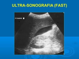 ULTRA-SONOGRAFIA (FAST)
 