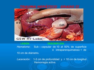 TRAUMA HEPÁTICO GRADO II
Hematoma : Sub – capsular de 10 al 50% de superficie
ó intraparenquimatoso < de
10 cm de diámetro.
Laceración : 1-3 cm de profundidad y < 10 cm de longitud.
Hemorragia activa.
LESION DESCRIPCION
 