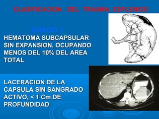 CLASIFICACION DEL TRAUMA ESPLENICO
GRADO I
HEMATOMA SUBCAPSULARHEMATOMA SUBCAPSULAR
SIN EXPANSION, OCUPANDOSIN EXPANSION, OCUPANDO
MENOS DEL 10% DEL AREAMENOS DEL 10% DEL AREA
TOTALTOTAL
LACERACION DE LALACERACION DE LA
CAPSULA SIN SANGRADOCAPSULA SIN SANGRADO
ACTIVO, < 1 Cm DEACTIVO, < 1 Cm DE
PROFUNDIDADPROFUNDIDAD
 