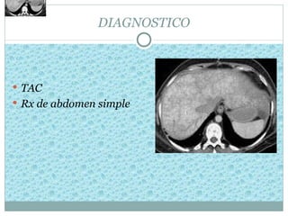 DIAGNOSTICO



 TAC
 Rx de abdomen simple
 