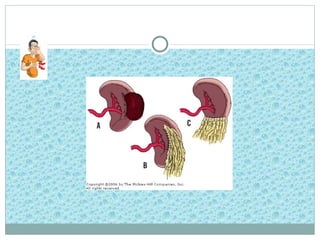Trauma abdominal y genitourinario
