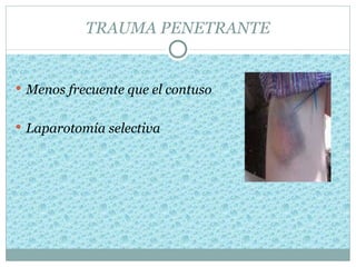 TRAUMA PENETRANTE


 Menos frecuente que el contuso


 Laparotomía selectiva
 