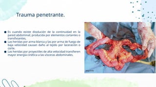 Traumatismo de abdomen y pelvis cirugia.pptx