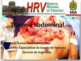 Trauma abdominal
Dr. Eduardo Gomez Sanchez R3UMQx
Hospital Alta Especialidad de Estado de Veracruz
Servicio de Urgencias
 