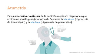 Acumetria
Es la exploración cualitativa de la audición mediante diapasones que
emiten un sonido puro (monotonal). Se valora la vía aérea (Hipoacusia
de transmisión) y la vía ósea (Hipoacusia de percepción).
 