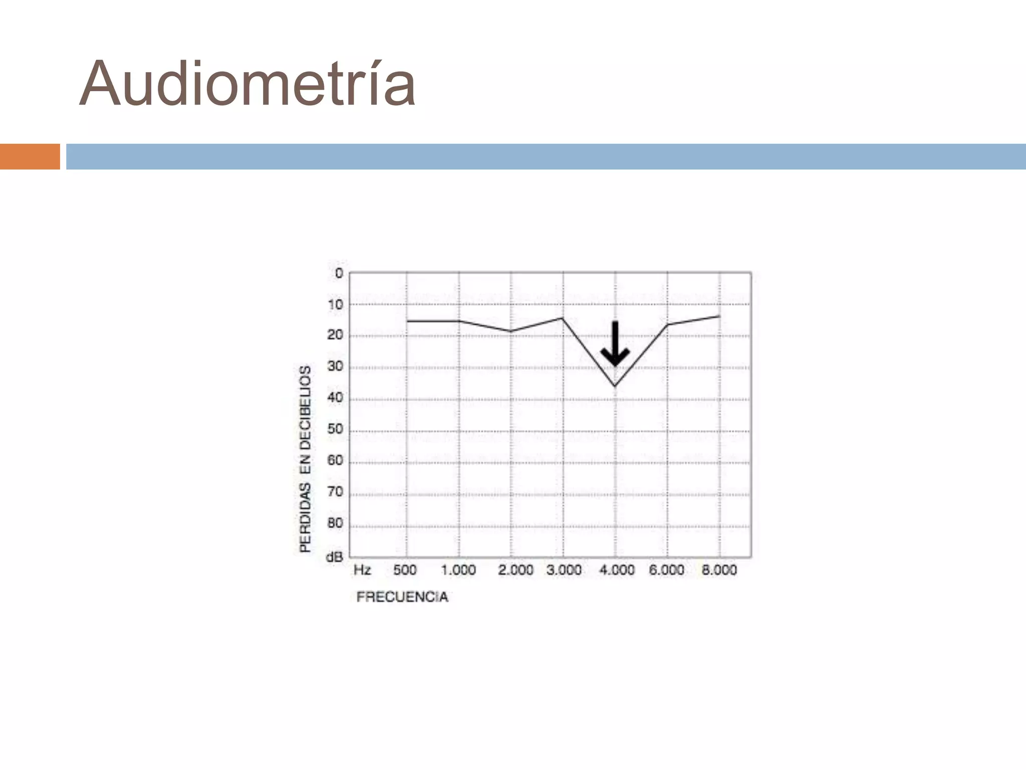 Audiometría
 
