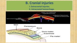 B. Cranial injuries
I. Extracranial injuries.
II. Intracranial hemorrhage.
 