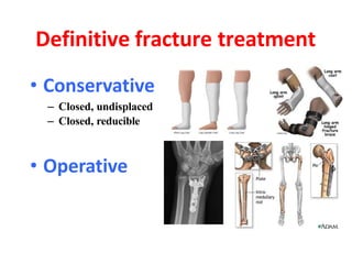 Trauma approach | PPTX