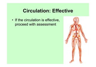 Circulation: Effective
• If the circulation is effective,
  proceed with assessment
 