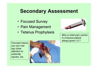Secondary Assessment
     • Focused Survey
     • Pain Management
     • Tetanus Prophylaxis
                             Why is initial pain control
                             In a trauma patient
                             always given I.V.?
Focused means
you can now
pay close
attention to
extremity
injuries, etc.
 