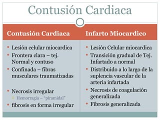 Trauma cardiaco cerrado