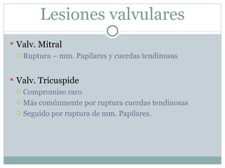 Trauma cardiaco cerrado